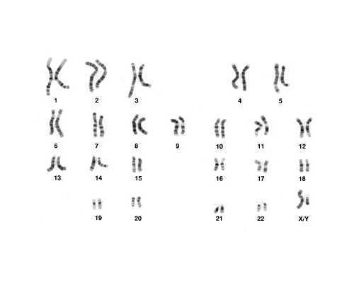 私人助孕宝宝~怀孕两个月肚子受到撞击后果